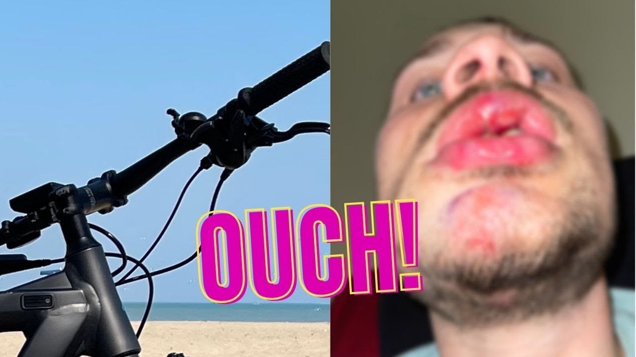 قصة حادثتي مع الدراجة!!